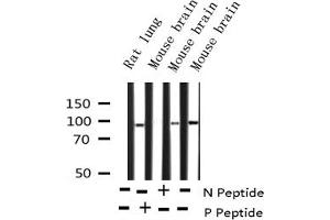 Western blot analysis of Phospho-PKCD (Tyr64) expression in various lysates
