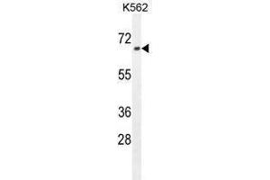 ZN169 Antibody (N-term) western blot analysis in K562 cell line lysates (35 µg/lane). (ZNF169 anticorps  (N-Term))