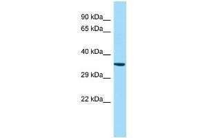 WB Suggested Anti-GPR160 Antibody Titration: 1. (GPR160 anticorps  (N-Term))