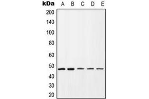 Western blot analysis of CD184 (pS339) expression in HEK293T colchicine-treated (A), HL60 (B), Jurkat (C), mouse spleen (D), rat spleen (E) whole cell lysates.