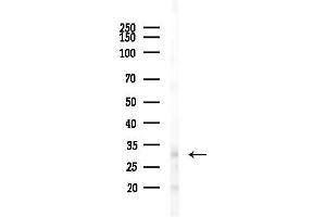 anti-Hydroxysteroid (17-Beta) Dehydrogenase 14 (HSD17B14) (C-Term) antibody