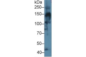Detection of COL4a3 in Mouse Skeletal muscle lysate using Polyclonal Antibody to Collagen Type IV Alpha 3 (COL4a3) (COL4a3 anticorps  (AA 1428-1670))