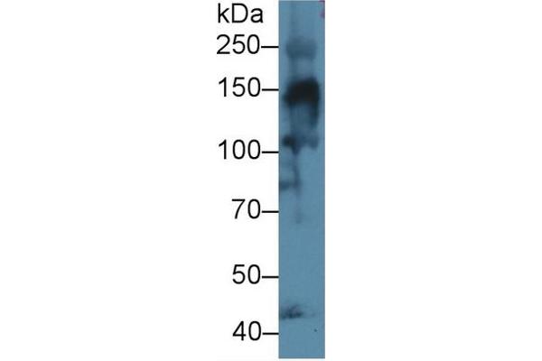 COL4a3 anticorps  (AA 1428-1670)