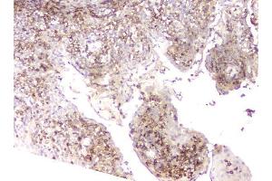 IHC analysis of LCP1 using anti-LCP1 antibody (ABIN6719421). (LCP1 anticorps)