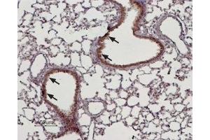 Expression of TRPM4 in rat lung - Immunohistochemical staining of rat lung paraffin embedded sections using Anti-TRPM4 Antibody (ABIN7043833, ABIN7044008 and ABIN7044009), (1:100).
