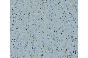 IHC analysis of Cyclophilin E/PPIE using anti-Cyclophilin E/PPIE antibody (ABIN7599243). (PPIE anticorps  (AA 1-301))