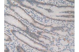 IHC-P analysis of Human Stomach Tissue, with DAB staining. (ACAT2 anticorps  (AA 1-397))