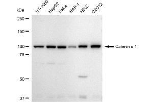Western blotting analysis using Catenin alpha 1 antibody (ABIN7797923). (Recombinant CTNNA1 anticorps)