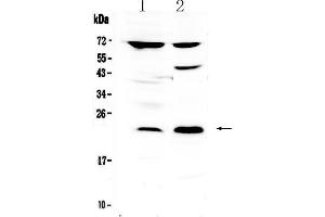 Western blot analysis of TRFP / MED20 using anti-TRFP / MED20 antibody .