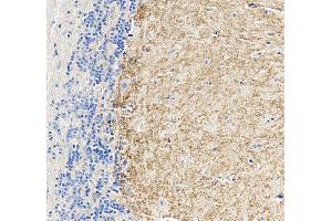 IHC analysis of CHRM1 using anti-CHRM1 antibody (ABIN7602749).