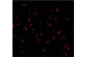 Immunofluorescence of ATG7 in MCF7 cells with ATG7 Antibody at 20 µg/ml.