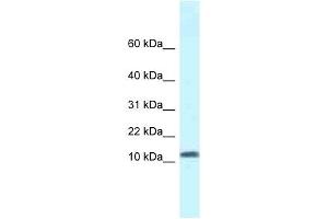 Western Blot showing SSBP1 antibody used at a concentration of 1 ug/ml against Fetal Kidney Lysate (SSBP1 anticorps  (N-Term))