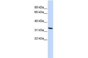 WB Suggested Anti-HMG20A Antibody Titration: 0. (HMG20A anticorps  (N-Term))
