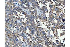 IHC analysis of TRAM1L1 using anti-TRAM1L1 antibody (ABIN7602939). (TRAM1L1 anticorps  (C-Term))