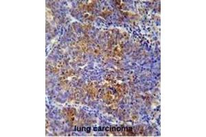 Immunohistochemistry (IHC) image for anti-Activating Transcription Factor 7 Interacting Protein 2 (ATF7IP2) antibody (ABIN2995682) (ATF7IP2 anticorps)