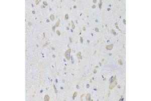 anti-Eukaryotic Translation Elongation Factor 1 beta 2 (EEF1B2) (AA 1-225) antibody