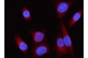 IF analysis of Lipin 1/LPIN1 using anti-Lipin 1/LPIN1 antibody (ABIN7602648). (Lipin 1 anticorps  (AA 90-886))