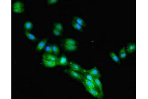 Immunofluorescent analysis of HepG2 cells using ABIN7156043 at dilution of 1:100 and Alexa Fluor 488-congugated AffiniPure Goat Anti-Rabbit IgG(H+L) (FcRn anticorps  (AA 24-297))