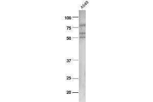 A549 cell lysates probed with Anti-pan-Cytokeratin Polyclonal Antibody, Unconjugated  at 1:5000 90min in 37˚C. (Cytokeratin 1 anticorps  (AA 101-200))