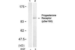 Western blot analysis of extracts from SKOV3 cells untreated(lane 1) or treated with EGF(lane 2) using Progesterone Receptor(Phospho-Ser190) Antibody. (Progesterone Receptor anticorps  (pSer190))