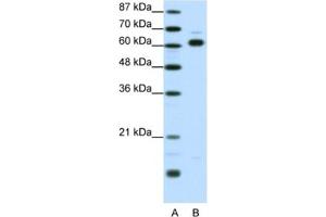 Western Blotting (WB) image for anti-Thyroid Hormone Receptor Interactor 4 (TRIP4) antibody (ABIN2461241) (TRIP4 anticorps)