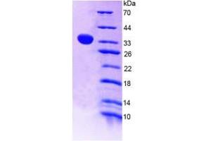 SDS-PAGE (SDS) image for Angiopoietin-Like 4 (ANGPTL4) (AA 182-394) protein (His tag) (ABIN1169871)