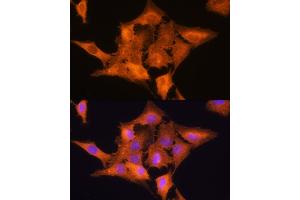 Immunofluorescence analysis of C6 cells using ALDOC Rabbit pAb (ABIN6129897, ABIN6136788, ABIN6136789 and ABIN6215308) at dilution of 1:100. (ALDOC anticorps  (AA 1-170))