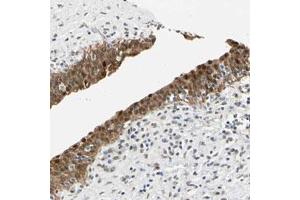 Immunohistochemical staining (Formalin-fixed paraffin-embedded sections) of human urinary bladder with MINA polyclonal antibody  shows strong nuclear and cytoplasmic positivity in urothelial cells. (MINA anticorps)