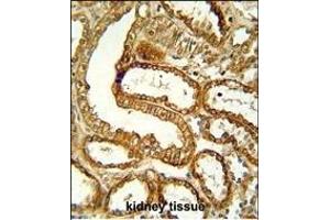 CCR1 Antibody (N-term) (ABIN651052 and ABIN2840048) immunohistochemistry analysis in formalin fixed and paraffin embedded human kidney tissue followed by peroxidase conjugation of the secondary antibody and DAB staining.