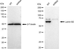 Western blotting analysis using Lamin B2 antibody (ABIN7799233). (Recombinant Lamin B2 anticorps)