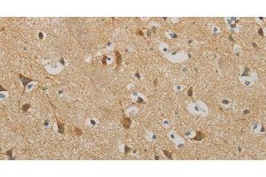 Immunohistochemistry of paraffin-embedded Human brain using IDH3G Polyclonal Antibody at dilution of 1:30