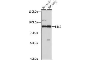 Western blot analysis of extracts of various cell lines, using BBS7 antibody (ABIN7265825) at 1:1000 dilution. (BBS7 anticorps  (AA 1-270))