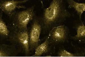 Immunofluorescence staining of human endothelial cells.