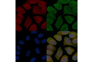 C14orf37 Antibody staining Hela cells(45 min of heat-shock treatment) by IF/ICC. (C14ORF37 anticorps)