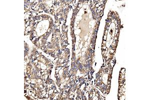 IHC analysis of MPPB/PMPCB using anti-MPPB/PMPCB antibody (ABIN7600758). (PMPCB anticorps  (AA 23-479))