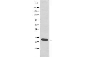 Western blot analysis of extracts from HepG2 cells using HSPB2 antibody. (HSPB2 anticorps  (Internal Region))