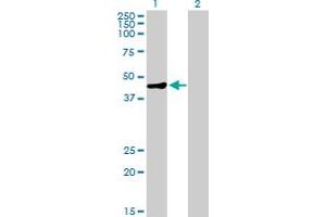 Western Blot analysis of MAGEA9 expression in transfected 293T cell line by MAGEA9 MaxPab polyclonal antibody.