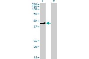 Western Blot analysis of MAGEA9 expression in transfected 293T cell line by MAGEA9 MaxPab polyclonal antibody. (MAGEA9 anticorps  (AA 1-315))