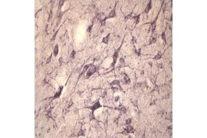 IHC on rat spinal cord using Rabbit antibody to extracellular, N-terminal part of Sortilin (Neurotensin receptor 3, NTR3, Sort1): IgG (ABIN350868) at a concentration of 10 µg/ml. (Sortilin 1 anticorps)