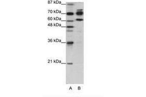 Image no. 1 for anti-Adenosine Deaminase, RNA-Specific, B1 (ADARB1) (AA 40-89) antibody (ABIN203245) (RED1 anticorps  (AA 40-89))