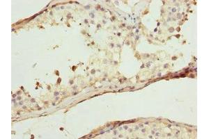 Immunohistochemistry of paraffin-embedded human testis tissue using ABIN7175708 at dilution of 1:100