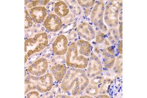 Immunohistochemistry of paraffin-embedded mouse kidney using CYP51A1 Antibody (ABIN5973683) at dilution of 1/100 (40x lens). (CYP51A1 anticorps)