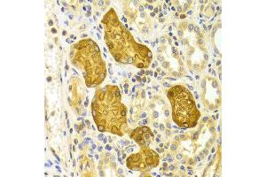 Immunohistochemistry of paraffin-embedded Human kidney using PRKCE antibody at dilution of 1:100 (x400 lens). (PKC epsilon anticorps)
