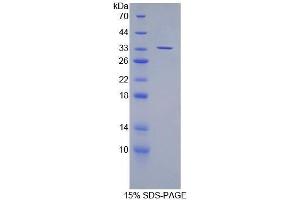 SDS-PAGE (SDS) image for Suppressor of Variegation 4-20 Homolog 2 (SUV420H2) (AA 2-279) protein (His tag) (ABIN1080877) (SUV420H2/KMT5C Protein (AA 2-279) (His tag))
