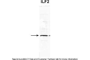 Sample Type: MCF-7 WT a whole cell lysates (110UG) Primary Dilution: 1. (ILF2 anticorps  (C-Term))