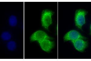 Detection of PDHb in Human Hela cell using Polyclonal Antibody to Pyruvate Dehydrogenase Beta (PDHb) (PDHB anticorps  (AA 31-341))