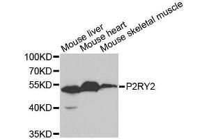 Western blot analysis of extracts of various cell lines, using P2RY2 antibody.