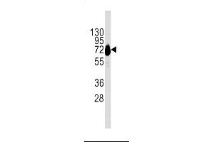 Western blot analysis of CDH10 Antibody in NCI-H460 cell line lysates (35ug/lane)