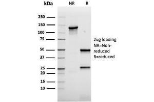 SDS-PAGE Analysis Purified AKT1 Recombinant Mouse Monoclonal Antibody (rAKT1/2491).