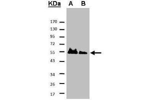 WB Image Sample A: His-Hice1 (2x) B: His-Hice1 (1x) 7.